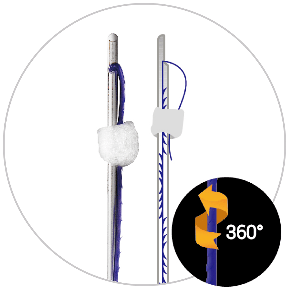 N-Cog Spiral-Multi Cannula Cogged Thread 21G/60Mm 6 Pcs.
